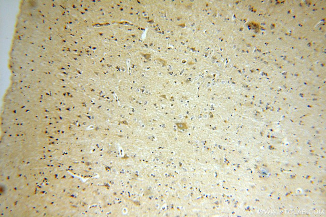 FIS1 Antibody in Immunohistochemistry (Paraffin) (IHC (P))