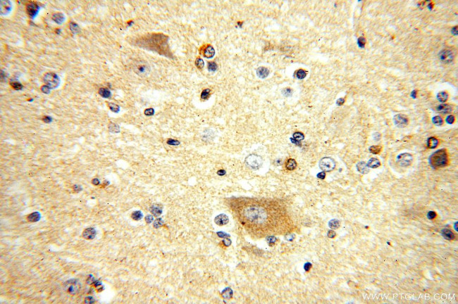 FIS1 Antibody in Immunohistochemistry (Paraffin) (IHC (P))