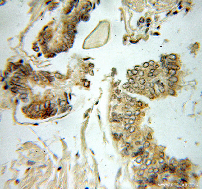 FIS1 Antibody in Immunohistochemistry (Paraffin) (IHC (P))