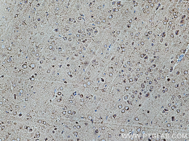 FIS1 Antibody in Immunohistochemistry (Paraffin) (IHC (P))