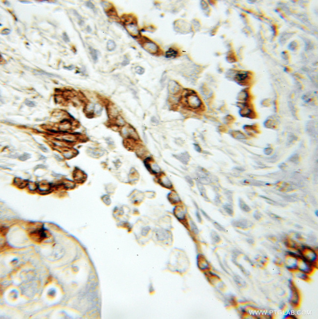 ACOX1 Antibody in Immunohistochemistry (Paraffin) (IHC (P))