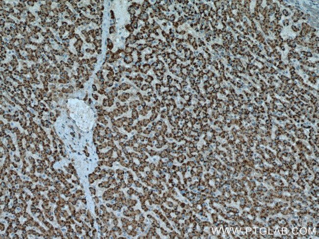 ACOX1 Antibody in Immunohistochemistry (Paraffin) (IHC (P))