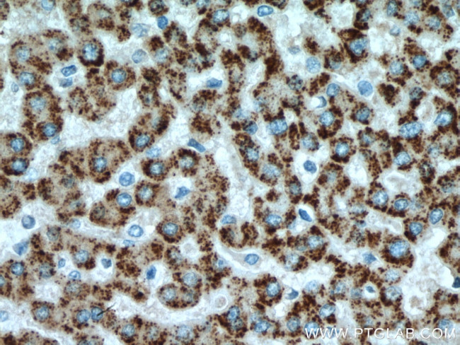 ACOX1 Antibody in Immunohistochemistry (Paraffin) (IHC (P))