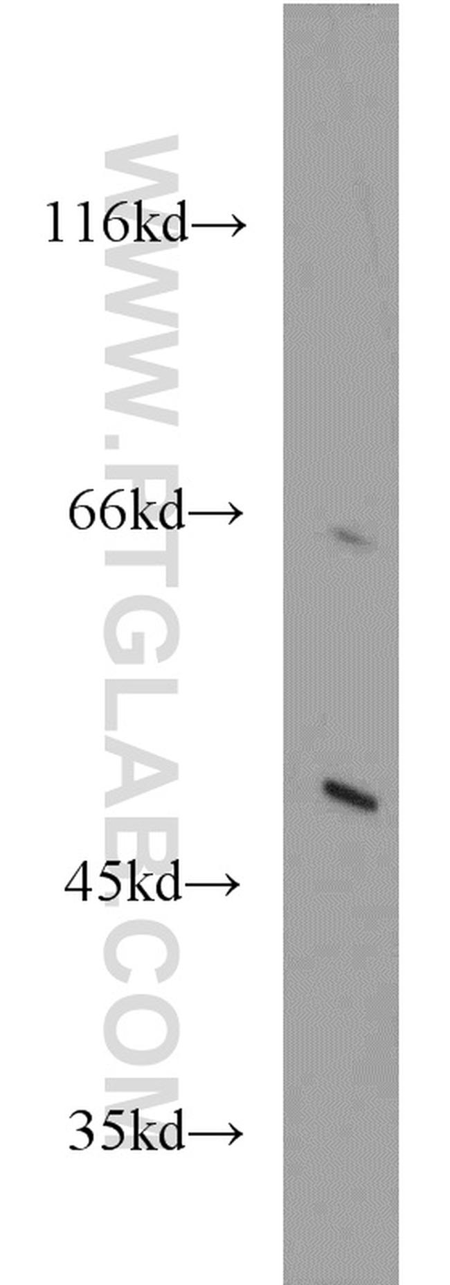 ACOX1 Antibody in Western Blot (WB)