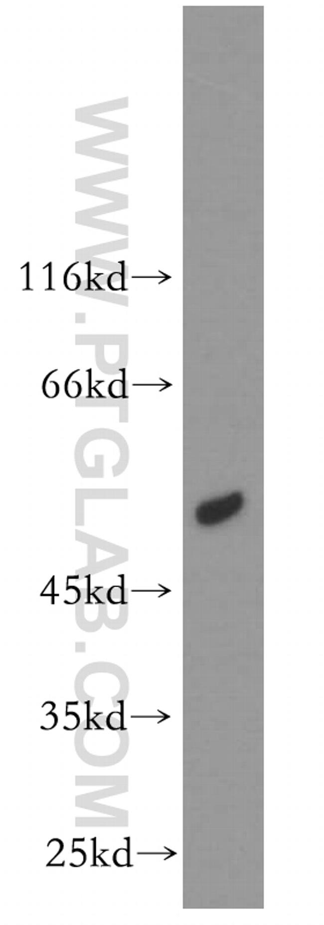 ACOX1 Antibody in Western Blot (WB)