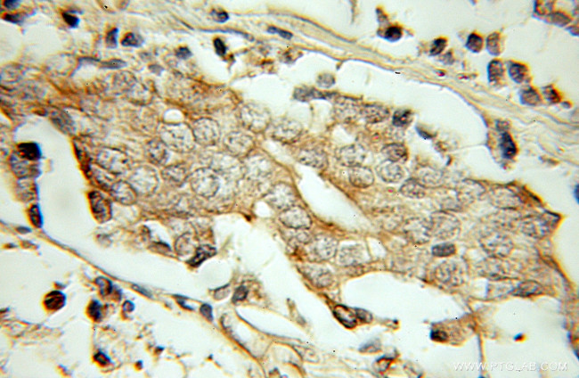 PSMG2 Antibody in Immunohistochemistry (Paraffin) (IHC (P))