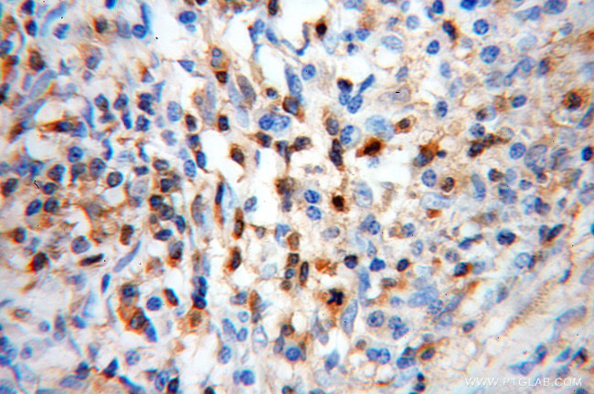 Cofilin Antibody in Immunohistochemistry (Paraffin) (IHC (P))