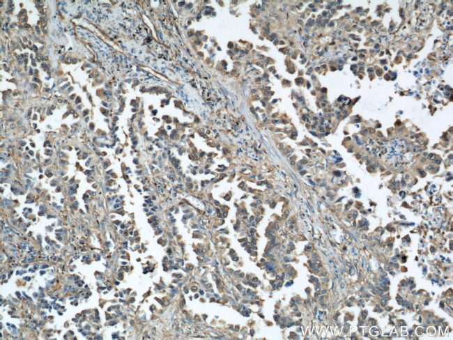 Cofilin Antibody in Immunohistochemistry (Paraffin) (IHC (P))