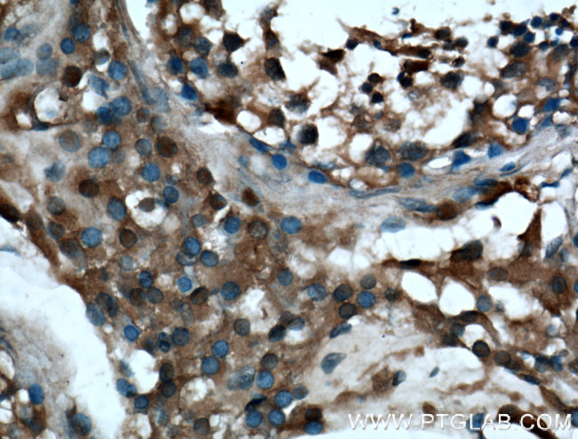 ARL3 Antibody in Immunohistochemistry (Paraffin) (IHC (P))