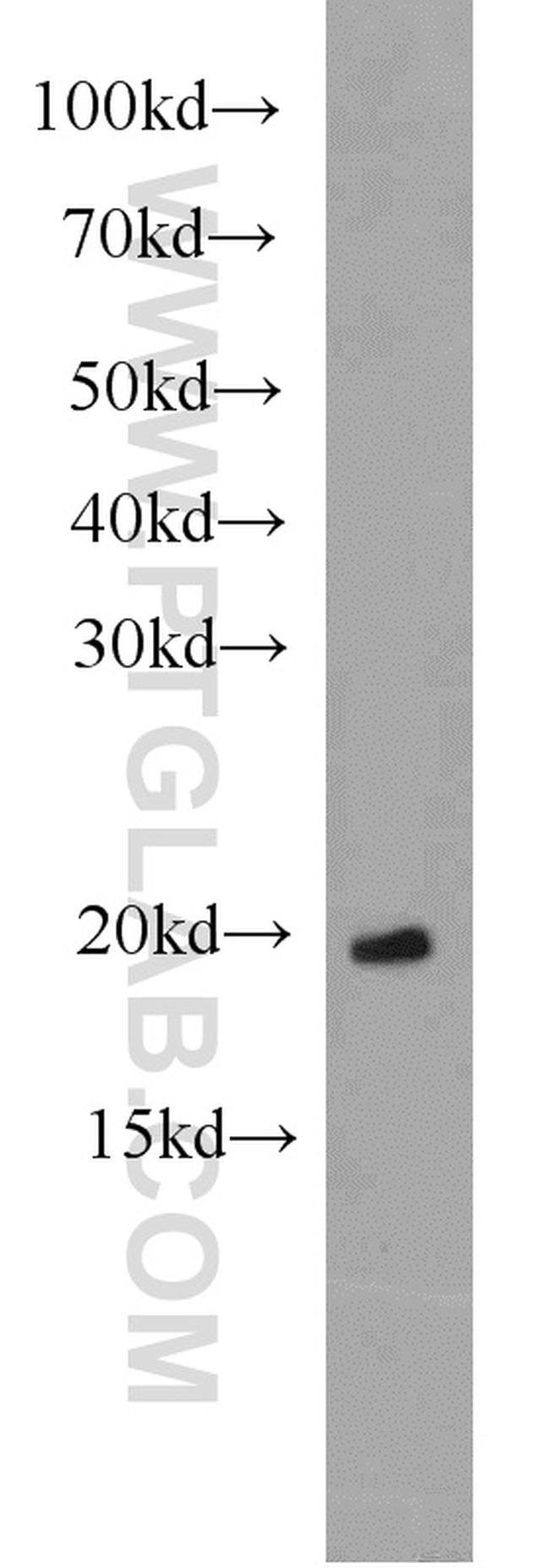 ARL3 Antibody in Western Blot (WB)