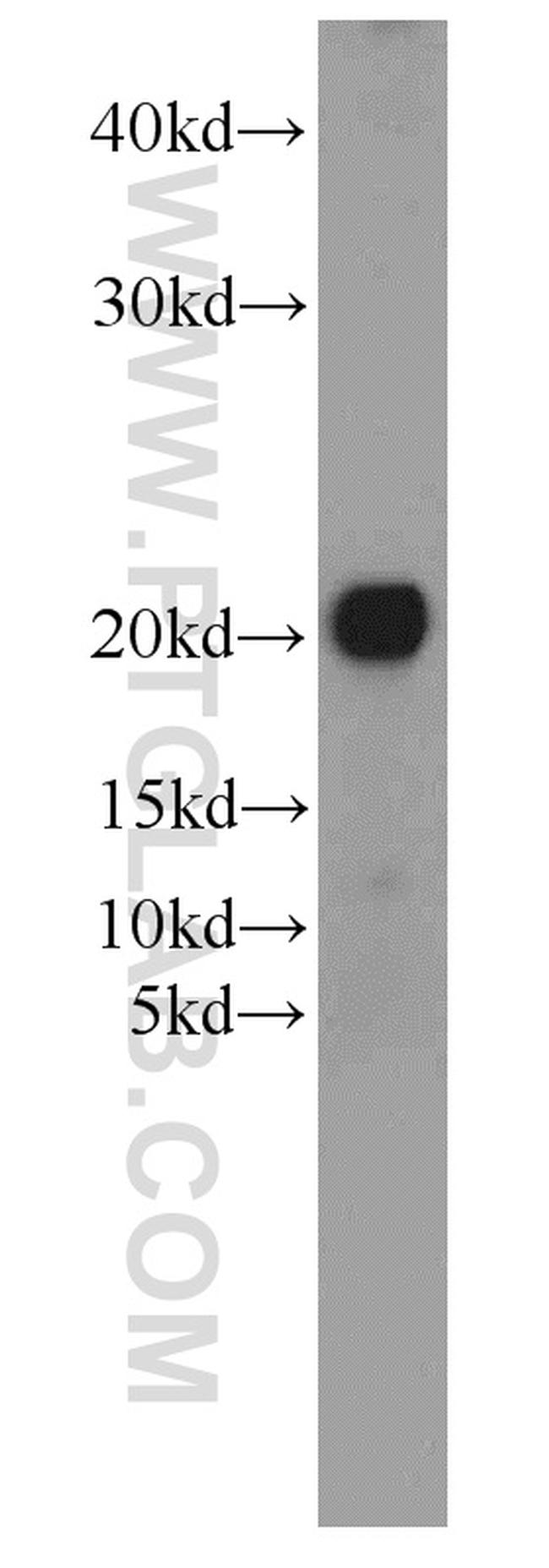 ARL3 Antibody in Western Blot (WB)