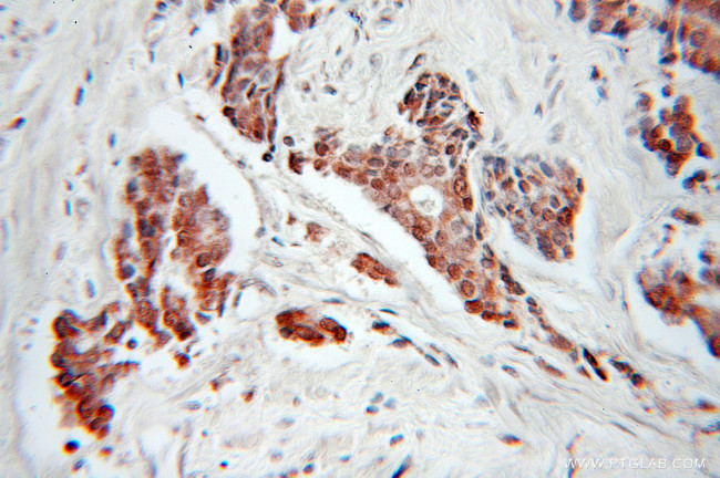 CDC34 Antibody in Immunohistochemistry (Paraffin) (IHC (P))