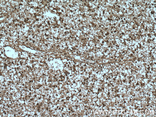 DCUN1D1 Antibody in Immunohistochemistry (Paraffin) (IHC (P))