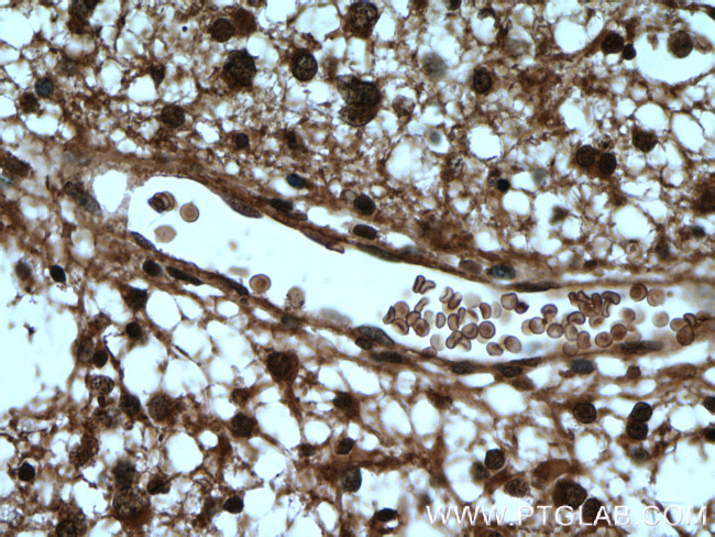 DCUN1D1 Antibody in Immunohistochemistry (Paraffin) (IHC (P))