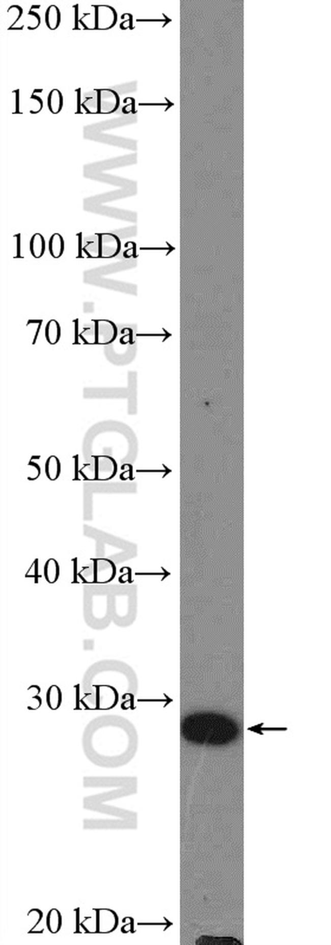 DCUN1D1 Antibody in Western Blot (WB)