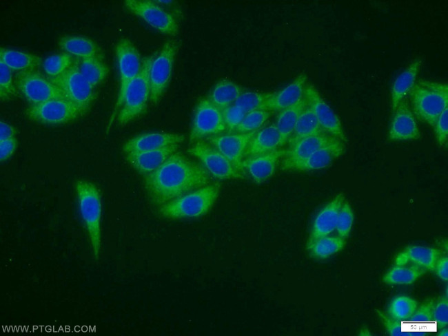 FH Antibody in Immunocytochemistry (ICC/IF)