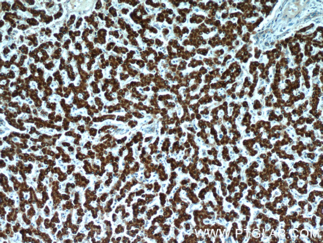 FH Antibody in Immunohistochemistry (Paraffin) (IHC (P))