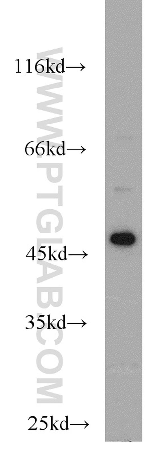 FH Antibody in Western Blot (WB)