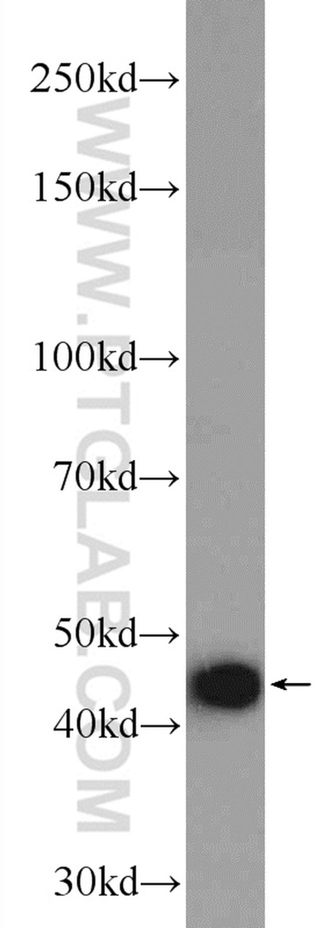 FH Antibody in Western Blot (WB)