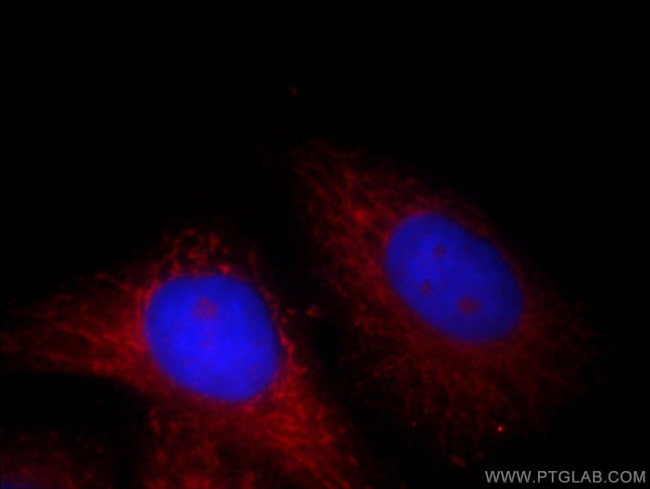 FH Antibody in Immunocytochemistry (ICC/IF)