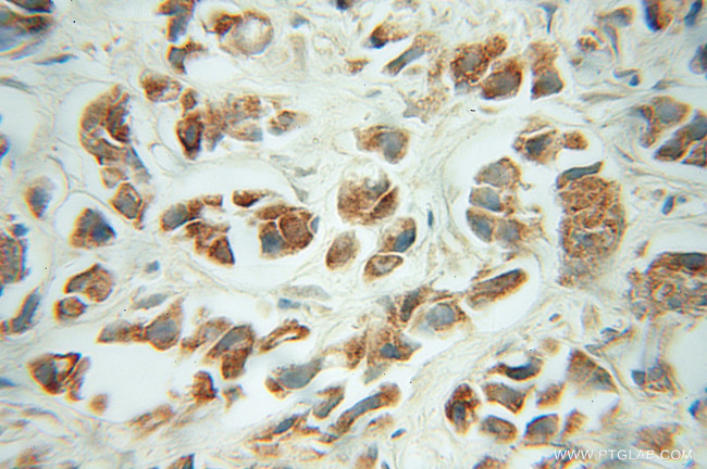 FH Antibody in Immunohistochemistry (Paraffin) (IHC (P))