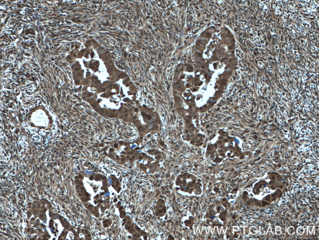 COPS2/TRIP15 Antibody in Immunohistochemistry (Paraffin) (IHC (P))