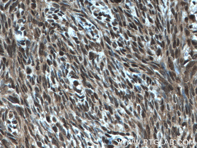 COPS2/TRIP15 Antibody in Immunohistochemistry (Paraffin) (IHC (P))