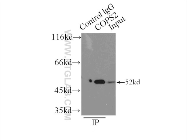 COPS2/TRIP15 Antibody in Immunoprecipitation (IP)