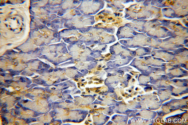 PABPC1/PABP Antibody in Immunohistochemistry (Paraffin) (IHC (P))