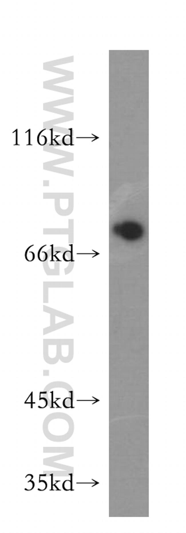 PABPC1/PABP Antibody in Western Blot (WB)