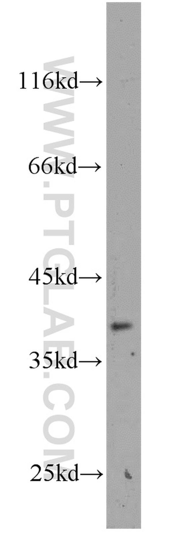 MAB21L2 Antibody in Western Blot (WB)