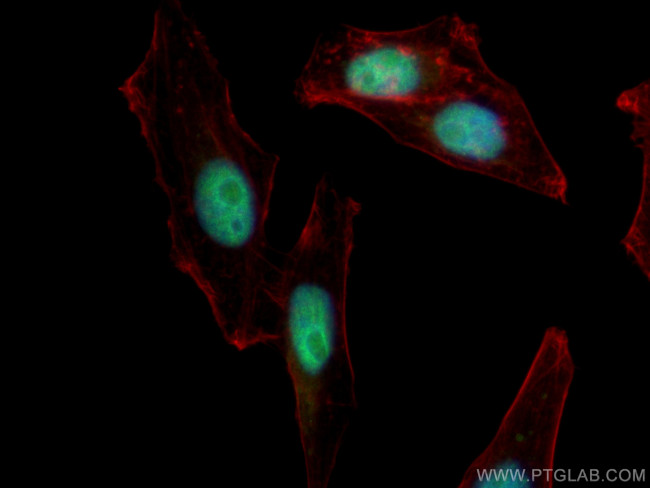 CTBP1 Antibody in Immunocytochemistry (ICC/IF)