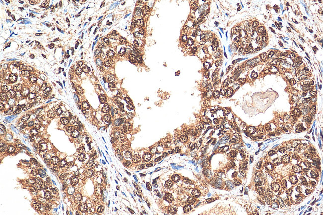 CTBP1 Antibody in Immunohistochemistry (Paraffin) (IHC (P))