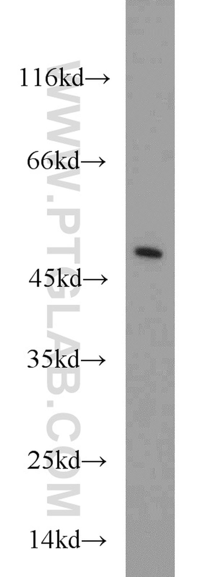 CTBP1 Antibody in Western Blot (WB)