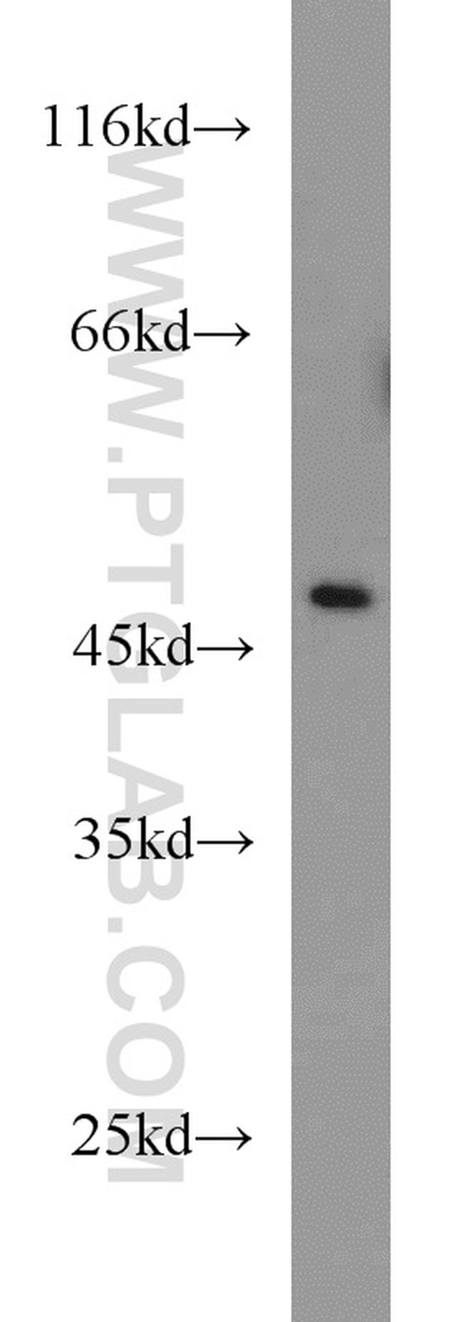 CTBP1 Antibody in Western Blot (WB)