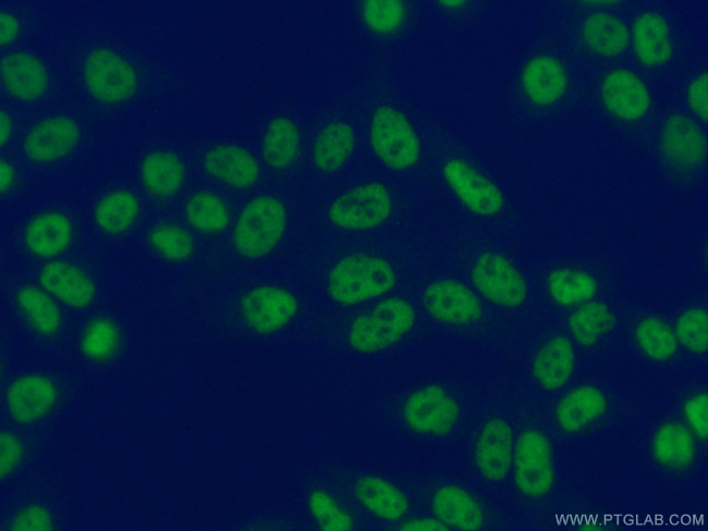 CTBP1 Antibody in Immunocytochemistry (ICC/IF)