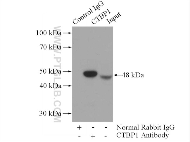 CTBP1 Antibody in Immunoprecipitation (IP)