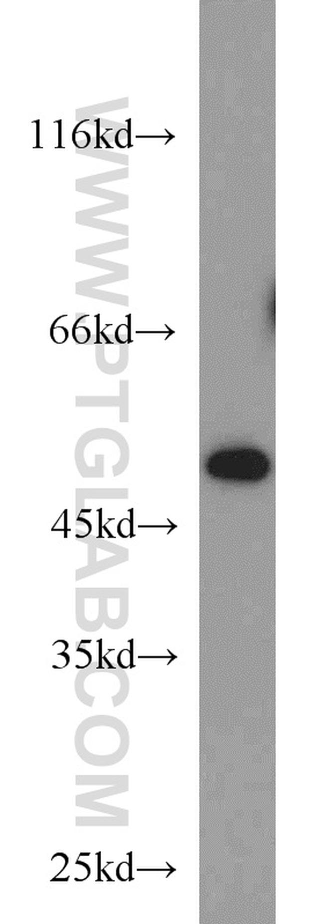 CTBP1 Antibody in Western Blot (WB)