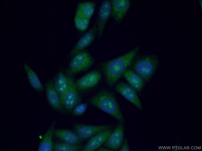 Nurr1/NR4A2 Antibody in Immunocytochemistry (ICC/IF)