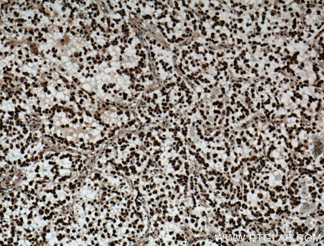 Nurr1/NR4A2 Antibody in Immunohistochemistry (Paraffin) (IHC (P))