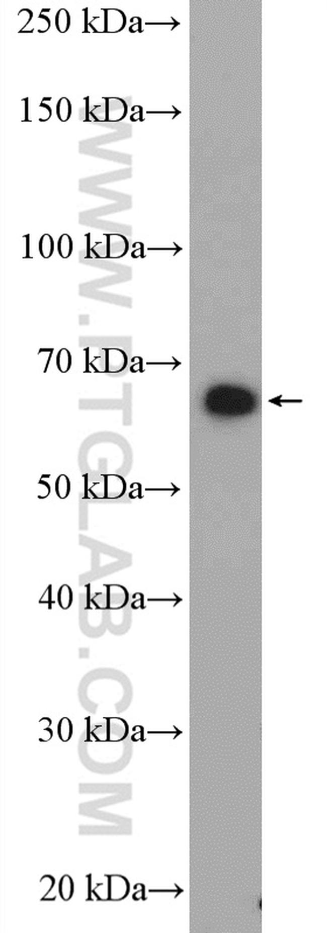 Nurr1/NR4A2 Antibody in Western Blot (WB)