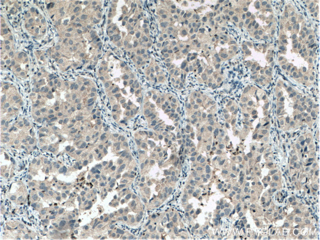 STXBP6 Antibody in Immunohistochemistry (Paraffin) (IHC (P))