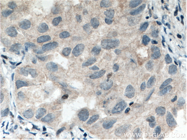 STXBP6 Antibody in Immunohistochemistry (Paraffin) (IHC (P))