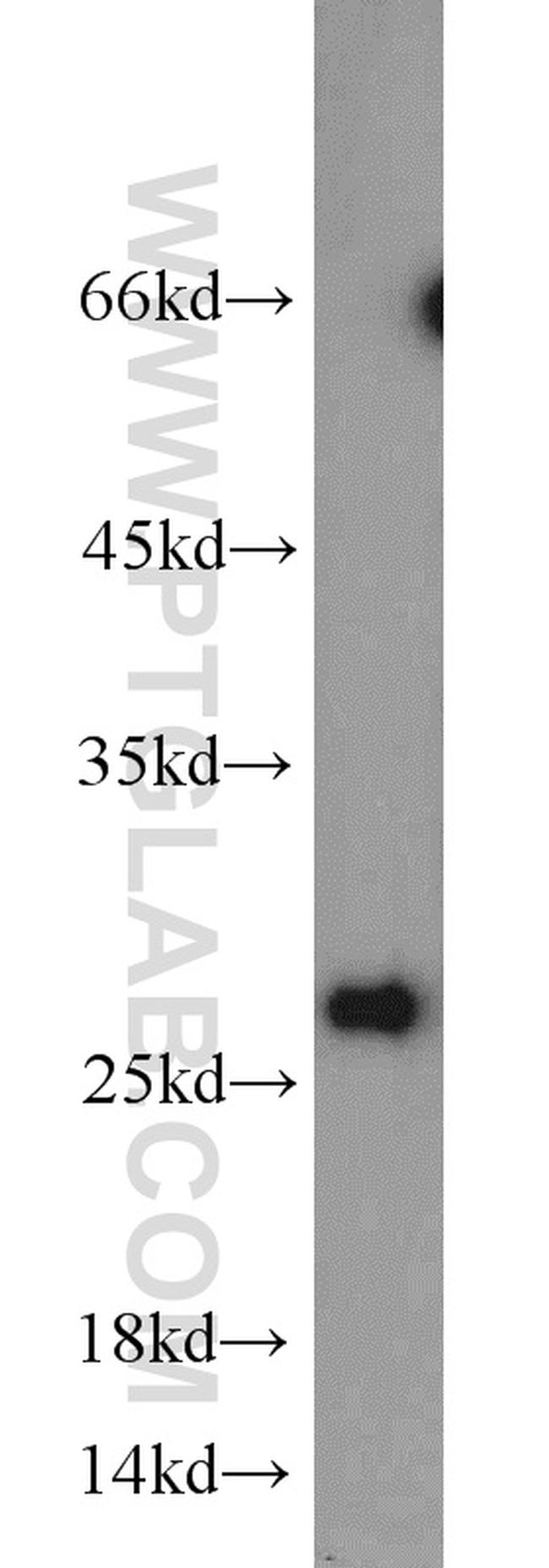STXBP6 Antibody in Western Blot (WB)