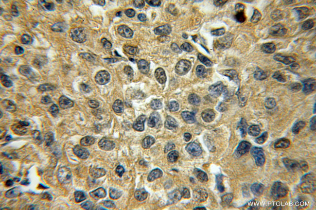 STXBP6 Antibody in Immunohistochemistry (Paraffin) (IHC (P))