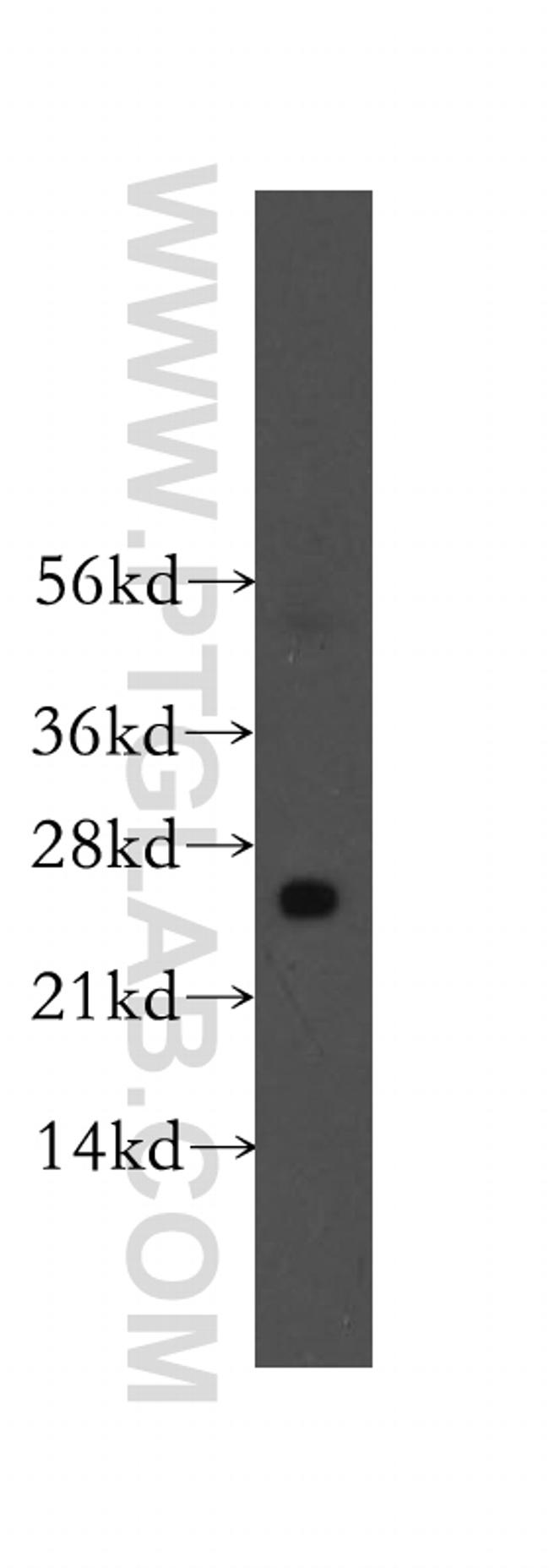 STXBP6 Antibody in Western Blot (WB)