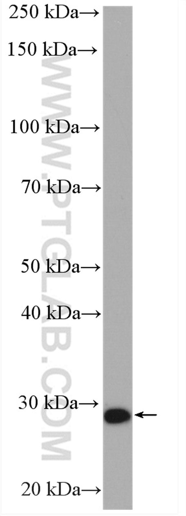 STXBP6 Antibody in Western Blot (WB)