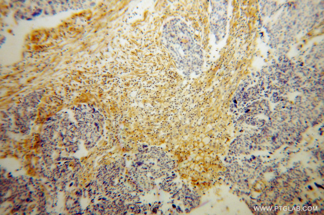 HSD17B2 Antibody in Immunohistochemistry (Paraffin) (IHC (P))