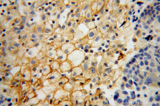 HSD17B2 Antibody in Immunohistochemistry (Paraffin) (IHC (P))