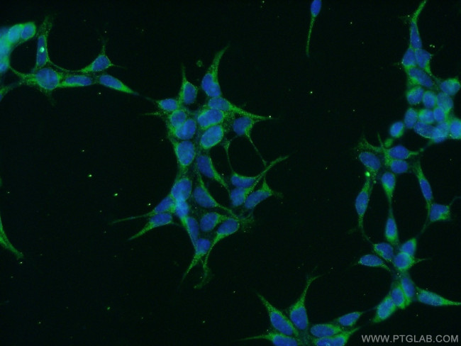 GRP94 Antibody in Immunocytochemistry (ICC/IF)